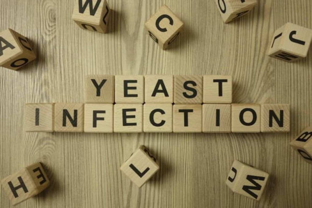 How to Get Rid of a Yeast Infection