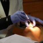 dental intraoral scanner