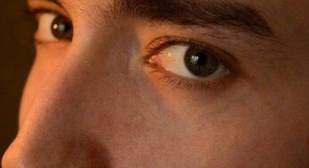 Exactly what are Dark Circles Under The Vision and How to Deal With Them?
