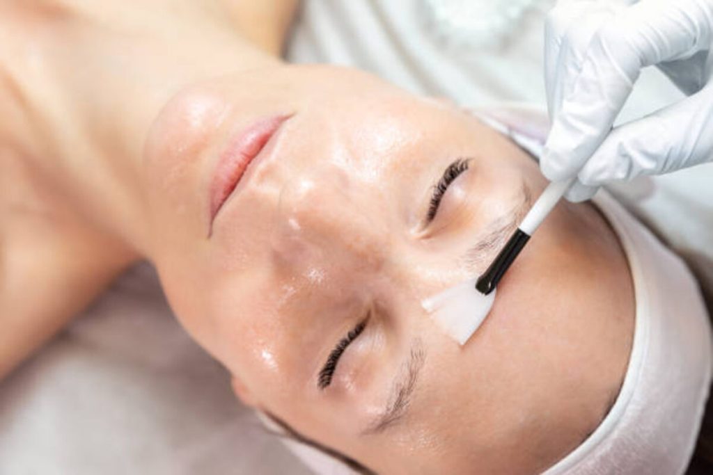 rf microneedling