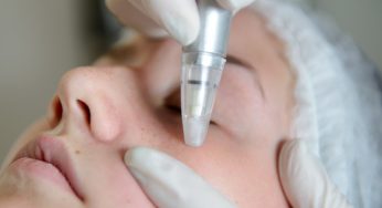 What is a Microdermabrasion Machine?
